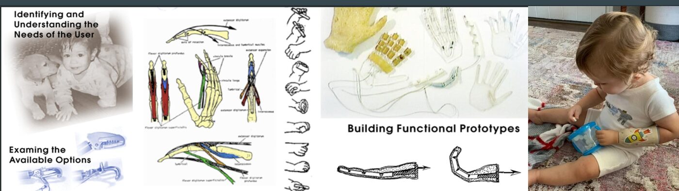 Child-size prosthetic hand prototype